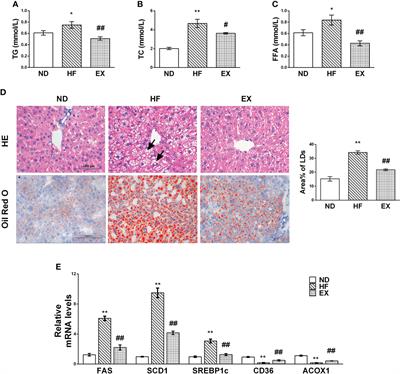 Exercise inhibits JNK pathway activation and lipotoxicity via macrophage migration inhibitory factor in nonalcoholic fatty liver disease